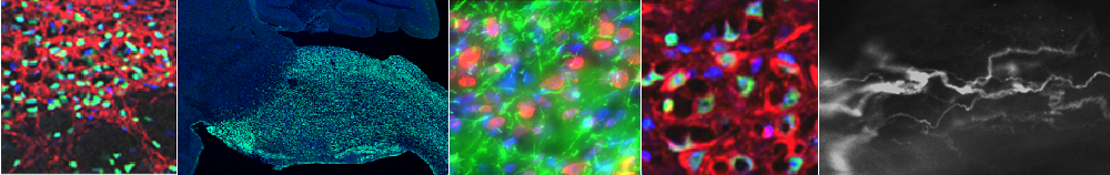 Research in the Neul Lab